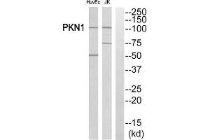Western Blotting (WB) image for anti-Protein Kinase N1 (PKN1) (Internal Region) antibody (ABIN1852725) (PKN1 anticorps  (Internal Region))
