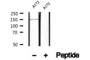 Western blot analysis of extracts of A172 cells, using Phospho-ULK1 (Ser467) Antibody.