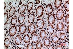 Immunohistochemistry (IHC) analysis of paraffin-embedded Human Colon, antibody was diluted at 1:100. (CACYBP anticorps  (C-Term))