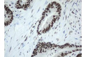 Image no. 4 for anti-Splicing Factor 3a, Subunit 1 (SF3A1) (AA 249-568) antibody (ABIN1491272)