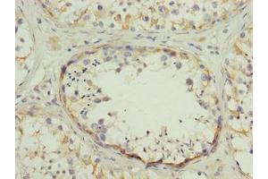 Immunohistochemistry of paraffin-embedded human testis tissue using ABIN7170536 at dilution of 1:100 (SPZ1 anticorps  (AA 181-430))