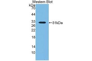 Detection of Recombinant LBP, Bovine using Polyclonal Antibody to Lipopolysaccharide Binding Protein (LBP)