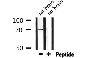 Western blot analysis of extracts from rat brain, using PROS1 Antibody.