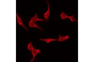 ABIN6267293 staining MDA-MB-435 by IF/ICC.