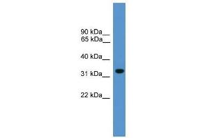 Western Blot showing BNIP1 antibody used at a concentration of 1-2 ug/ml to detect its target protein.