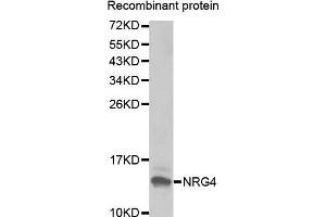 Western blot analysis of extracts of Recombinant protein, using NRG4 antibody. (Neuregulin 4 anticorps  (AA 1-115))
