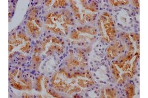 IHC image of ABIN7127386 diluted at 1:100 and staining in paraffin-embedded human kidney tissue performed on a Leica BondTM system.