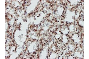 Immunoperoxidase of monoclonal antibody to MAPK9 on formalin-fixed paraffin-embedded human spleen tissue.