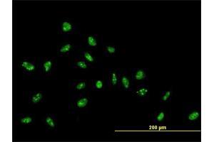 Immunofluorescence of purified MaxPab antibody to ZNF593 on HeLa cell. (ZNF593 anticorps  (AA 1-116))