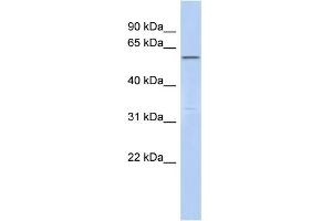 WB Suggested Anti-C6orf182 Antibody Titration: 0.