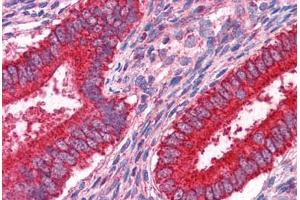 Human Uterus: Formalin-Fixed, Paraffin-Embedded (FFPE) (JUP anticorps  (AA 1-746))