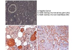 Immunohistochemistry with anti-nestin antibody showing nestin staining in cytoplasm of of ductal epithelium of human salivary gland (B) and in nucleus and cytoplasm of human breast tissue (C).