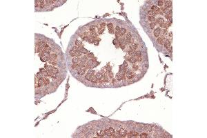 Immunohistochemistry of paraffin-embedded rat testis using NCK11 Rabbit mAb (ABIN7268834) at dilution of 1:100 (40x lens). (NCK1 anticorps)