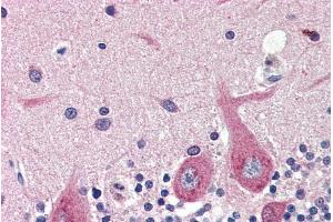 ABIN334405 (4µg/ml) staining of paraffin embedded Human Cerebellum. (GAD anticorps  (Internal Region))