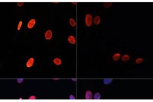 Immunofluorescence analysis of NIH/3T3 cells using Acetyl-Histone H3-K56 Polyclonal Antibody at dilution of 1:100. (Histone 3 anticorps  (acLys56))