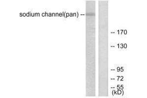 Western blot analysis of extracts from HuvEc cells, using Sodium Channel-pan antibody. (SCN5A anticorps)