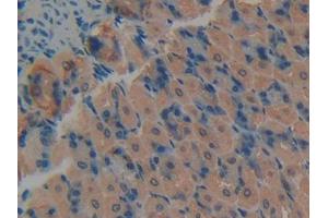 DAB staining on IHC-P; Samples: Mouse Stomach Tissue (PKC delta anticorps  (AA 328-674))
