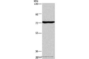 Western blot analysis of Mouse brain tissue, using KCND1 Polyclonal Antibody at dilution of 1:400 (KCND1 anticorps)