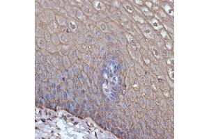 Immunohistochemistry of paraffin-embedded human esophageal using TMPRSS2 Rabbit mAb (ABIN7270946) at dilution of 1:100 (40x lens). (TMPRSS2 anticorps)