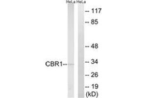 Western blot analysis of extracts from HeLa cells, using CBR1 Antibody. (CBR1 anticorps  (AA 181-230))