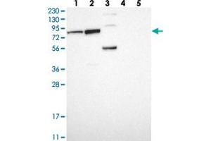 Western blot analysis of Lane 1: RT-4, Lane 2: U-251 MG, Lane 3: Human Plasma, Lane 4: Liver, Lane 5: Tonsil with PUS7 polyclonal antibody  at 1:250-1:500 dilution. (PUS7 anticorps)