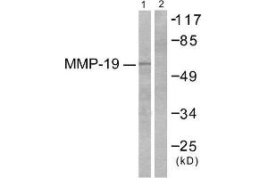 Western Blotting (WB) image for anti-Matrix Metallopeptidase 19 (MMP19) (N-Term) antibody (ABIN1848680) (MMP19 anticorps  (N-Term))