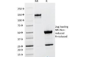 SDS-PAGE Analysis Purified TSH beta Mouse Monoclonal Antibody (TSHb/1317). (TSHB anticorps)