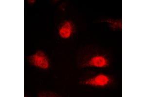 Immunofluorescent analysis of hnRNP Q staining in HeLa cells. (SYNCRIP anticorps  (Center))