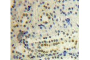 IHC-P analysis of Kidney tissue, with DAB staining. (PSMC3 anticorps  (AA 2-439))