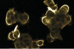 Immunofluorescence staining of MCF7 cells.