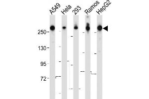 All lanes : Anti-FASN Antibody (Center) at 1:8000 dilution Lane 1: A549 whole cell lysate Lane 2: Hela whole cell lysate Lane 3: 293 whole cell lysate Lane 4: Ramos whole cell lysate Lane 5: HepG2 whole cell lysate Lysates/proteins at 20 μg per lane.