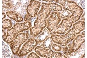 IHC-P Image VHL antibody detects VHL protein at cytosol on mouse kidney by immunohistochemical analysis. (VHL anticorps)