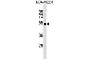 Western Blotting (WB) image for anti-Spinster Homolog 2 (SPNS2) antibody (ABIN2999753) (SPNS2 anticorps)