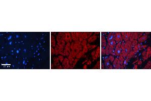 Rabbit Anti-FUBP1 Antibody   Formalin Fixed Paraffin Embedded Tissue: Human heart Tissue Observed Staining: Cytoplasmic, nucleus Primary Antibody Concentration: 1:100 Other Working Concentrations: N/A Secondary Antibody: Donkey anti-Rabbit-Cy3 Secondary Antibody Concentration: 1:200 Magnification: 20X Exposure Time: 0.