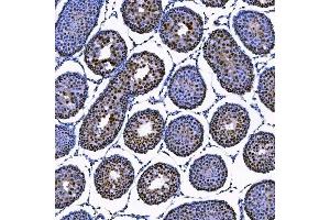IHC analysis of SAE1 using anti-SAE1 antibody (ABIN7601346). (SAE1 anticorps  (AA 33-299))