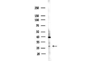 anti-rho GDP Dissociation Inhibitor (GDI) beta (ARHGDIB) (N-Term) antibody