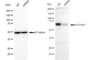 Western blotting analysis using Atg16L1 antibody (ABIN7797670).