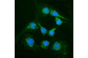 IF analysis of Alanine Transaminase/Gpt using anti-Alanine Transaminase/Gpt antibody (ABIN7600506). (ALT anticorps  (AA 2-496))