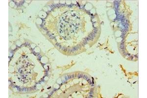 Immunohistochemistry of paraffin-embedded human small intestine tissue using ABIN7173327 at dilution of 1:100