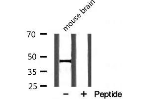 Western blot analysis on mouse brain lysate using TGF beta2 Antibody