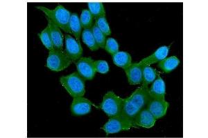 IF analysis of RAB11B using anti-RAB11B antibody (ABIN7602766). (RAB11B anticorps  (C-Term))
