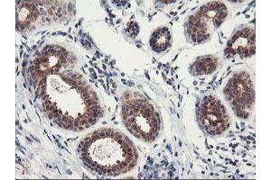 Immunohistochemistry (IHC) image for anti-Proteasome Subunit alpha 4 (PSMA4) antibody (ABIN1500457)