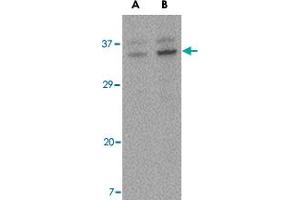Western blot analysis of ORAI3 in A-20 cell lysate with ORAI3 polyclonal antibody  at (A) 2 and (B) 4 ug/mL . (ORAI3 anticorps  (C-Term))