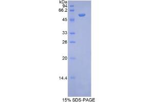 SDS-PAGE analysis of Rat NAGLU Protein. (N-Acetyl alpha-D-Glucosaminidase Protéine)