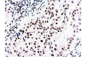 Image no. 19 for anti-5'-Nucleotidase Domain Containing 1 (NT5DC1) antibody (ABIN1499838)