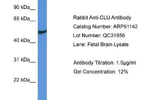 Western Blotting (WB) image for anti-Clusterin (CLU) (C-Term) antibody (ABIN2788692) (Clusterin anticorps  (C-Term))