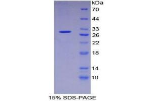 SDS-PAGE analysis of Human Intercellular Adhesion Molecule 3 Protein. (ICAM-3/CD50 Protéine)