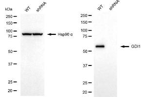 Western blotting analysis using GDI1 antibody (ABIN7798700). (GDI1 anticorps)