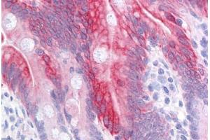 Human Small Intestine: Formalin-Fixed, Paraffin-Embedded (FFPE)