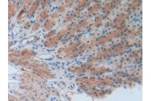 Detection of INV in Rat Stomach Tissue using Polyclonal Antibody to Involucrin (INV)